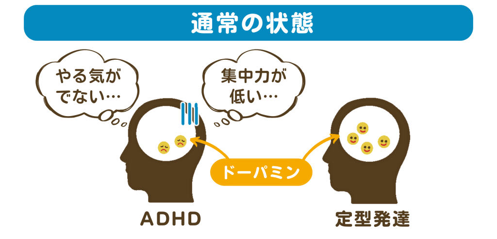 ADHDと定型発達のドーパミンの放出の違い（通常の状態）